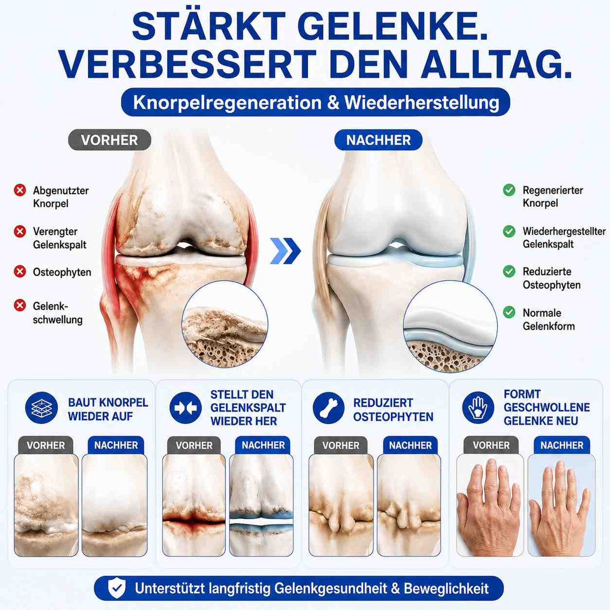 🦅❤️❤️❤️❤️GFOUK® Fortschrittliche Gelenkpflege-Creme