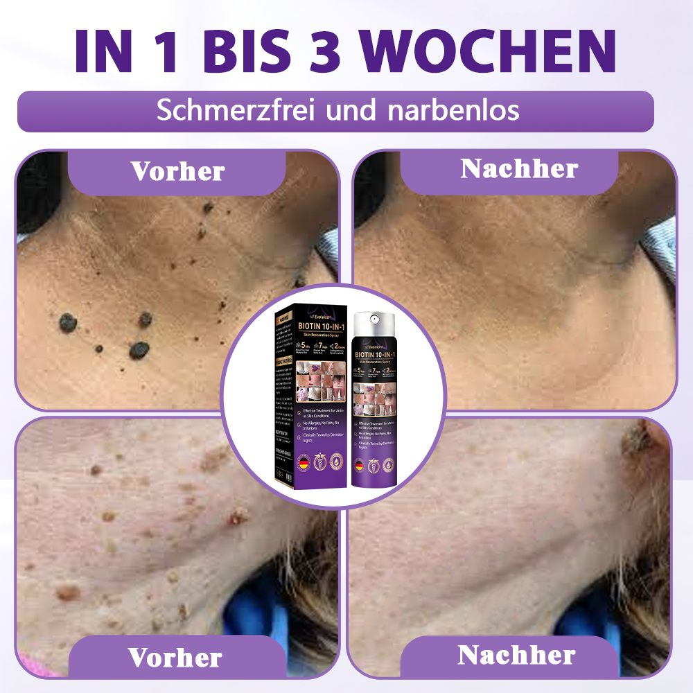 Hergestellt und versandt aus Deutschland ✨❤️Evolvion® Biotin 10-in-1 Hautregenerations-Spray🦅