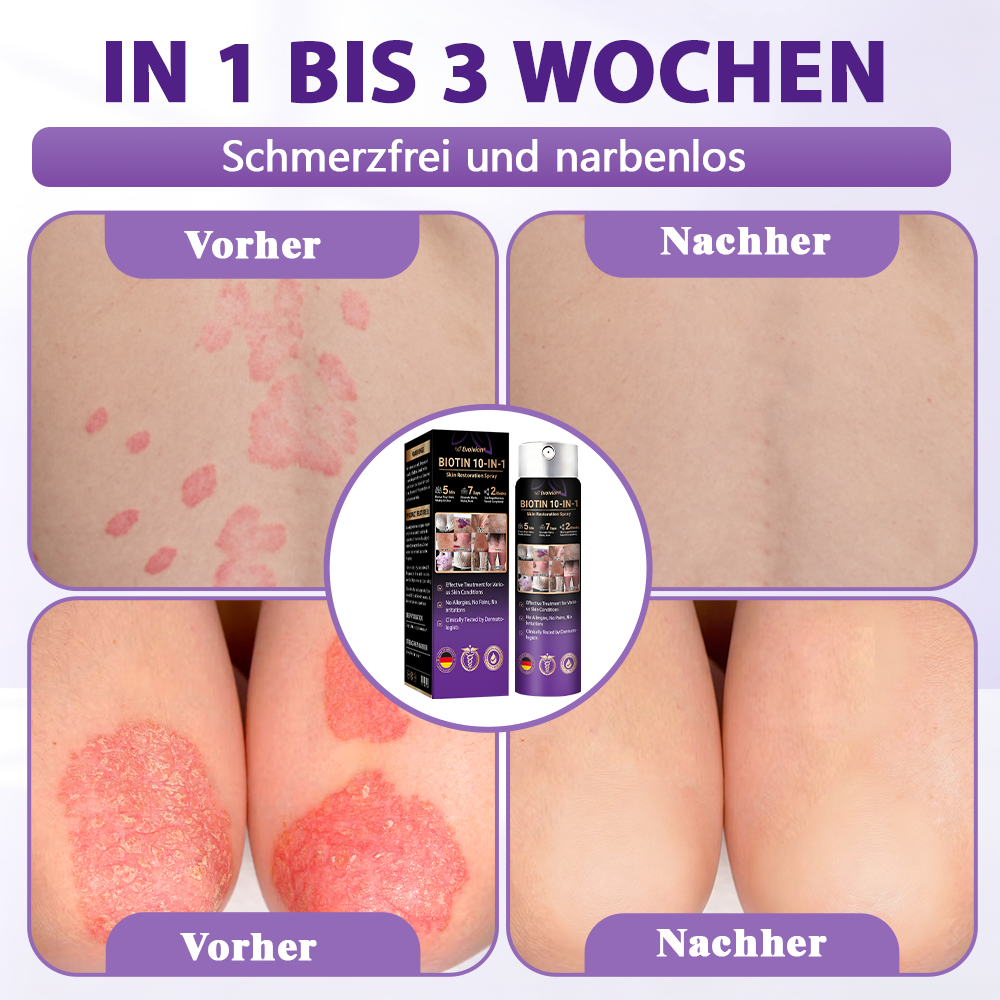 Hergestellt und versandt aus Deutschland ✨❤️Evolvion® Biotin 10-in-1 Hautregenerations-Spray🦅