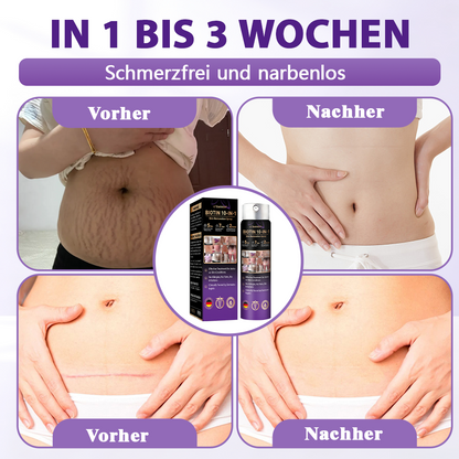 Hergestellt und versandt aus Deutschland ✨❤️Evolvion® Biotin 10-in-1 Hautregenerations-Spray🦅