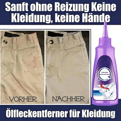 Aktivenzym-Waschfleckenentferner❤️