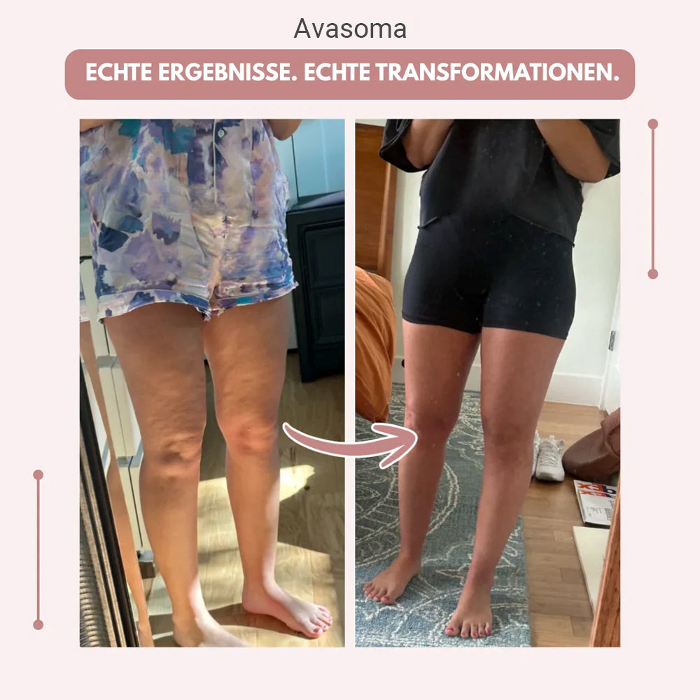 🍑3D Leggings – Definieren Sie Ihre Silhouette mühelos neu