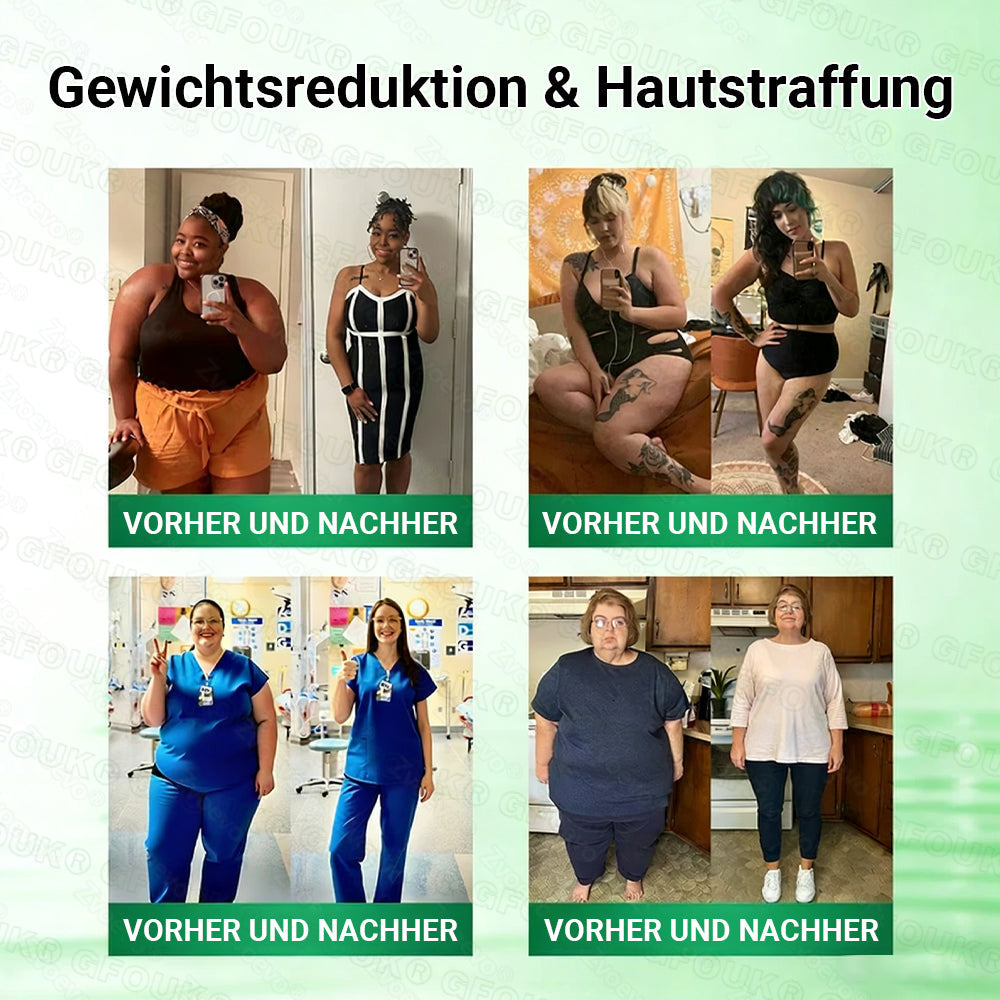 Offizieller Shop I🦅👨‍⚕️GFOUK® NAD+ 10-in-1-Pflaster mit fortschrittlicher Nano-Mikronadel-Technologie