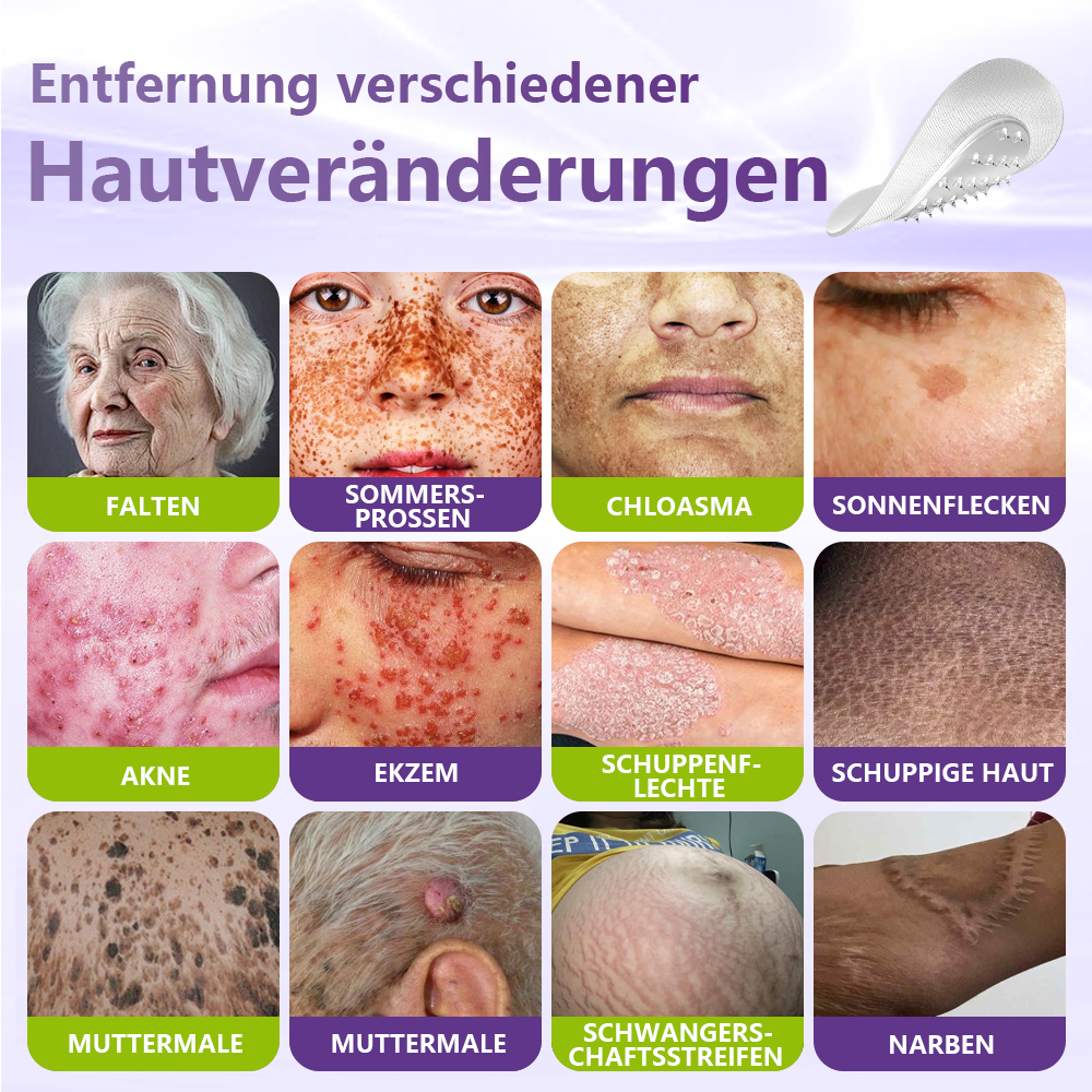 🦅GFOUK® Lösliches Mikronadel-Pflaster zur Entfernung von Hautanhängseln auf Pflanzenbasis
