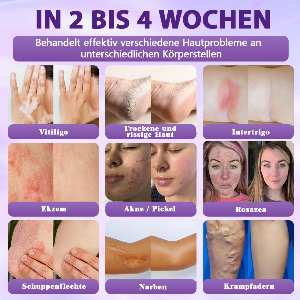 Hergestellt und versandt aus Deutschland ✨❤️Evolvion® Biotin 10-in-1 Hautregenerations-Spray🦅