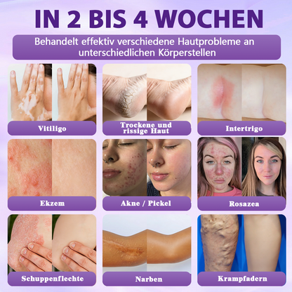Hergestellt und versandt aus Deutschland ✨❤️Evolvion® Biotin 10-in-1 Hautregenerations-Spray🦅