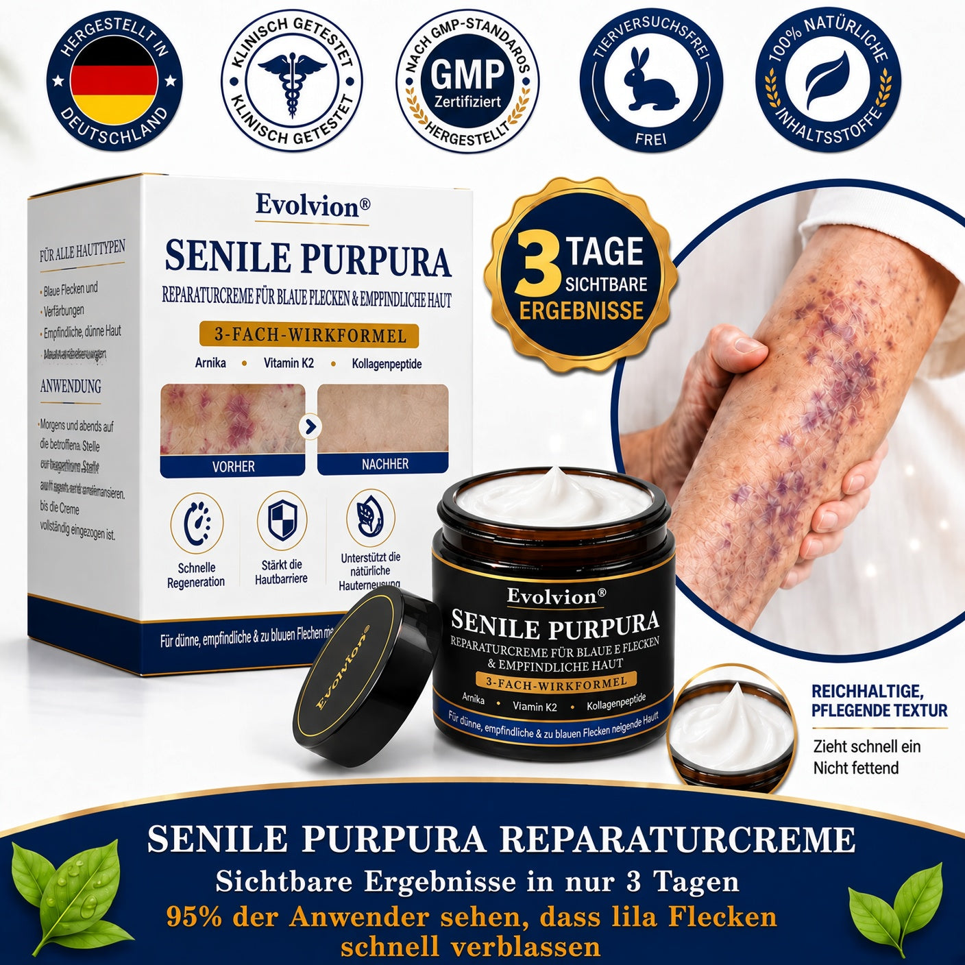 🦅Evolvion® Pflegecreme bei seniler Purpura, Blutergüssen & fragiler Haut