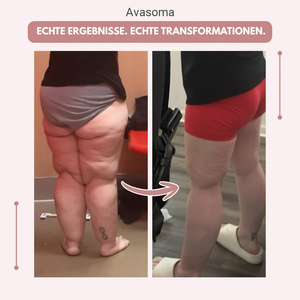 🍑3D Leggings – Definieren Sie Ihre Silhouette mühelos neu