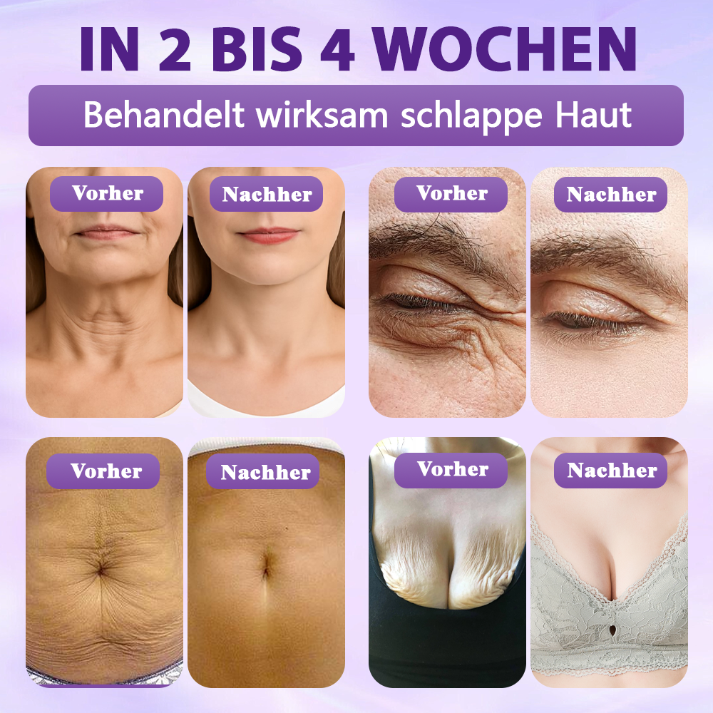 Hergestellt und versandt aus Deutschland ✨❤️Evolvion® Biotin 10-in-1 Hautregenerations-Spray🦅
