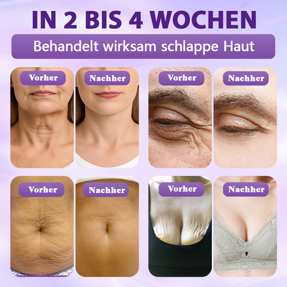 Hergestellt und versandt aus Deutschland ✨❤️Evolvion® Biotin 10-in-1 Hautregenerations-Spray🦅