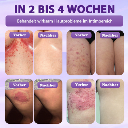Hergestellt und versandt aus Deutschland ✨❤️Evolvion® Biotin 10-in-1 Hautregenerations-Spray🦅