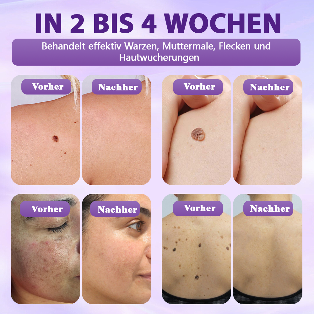Hergestellt und versandt aus Deutschland ✨❤️Evolvion® Biotin 10-in-1 Hautregenerations-Spray🦅