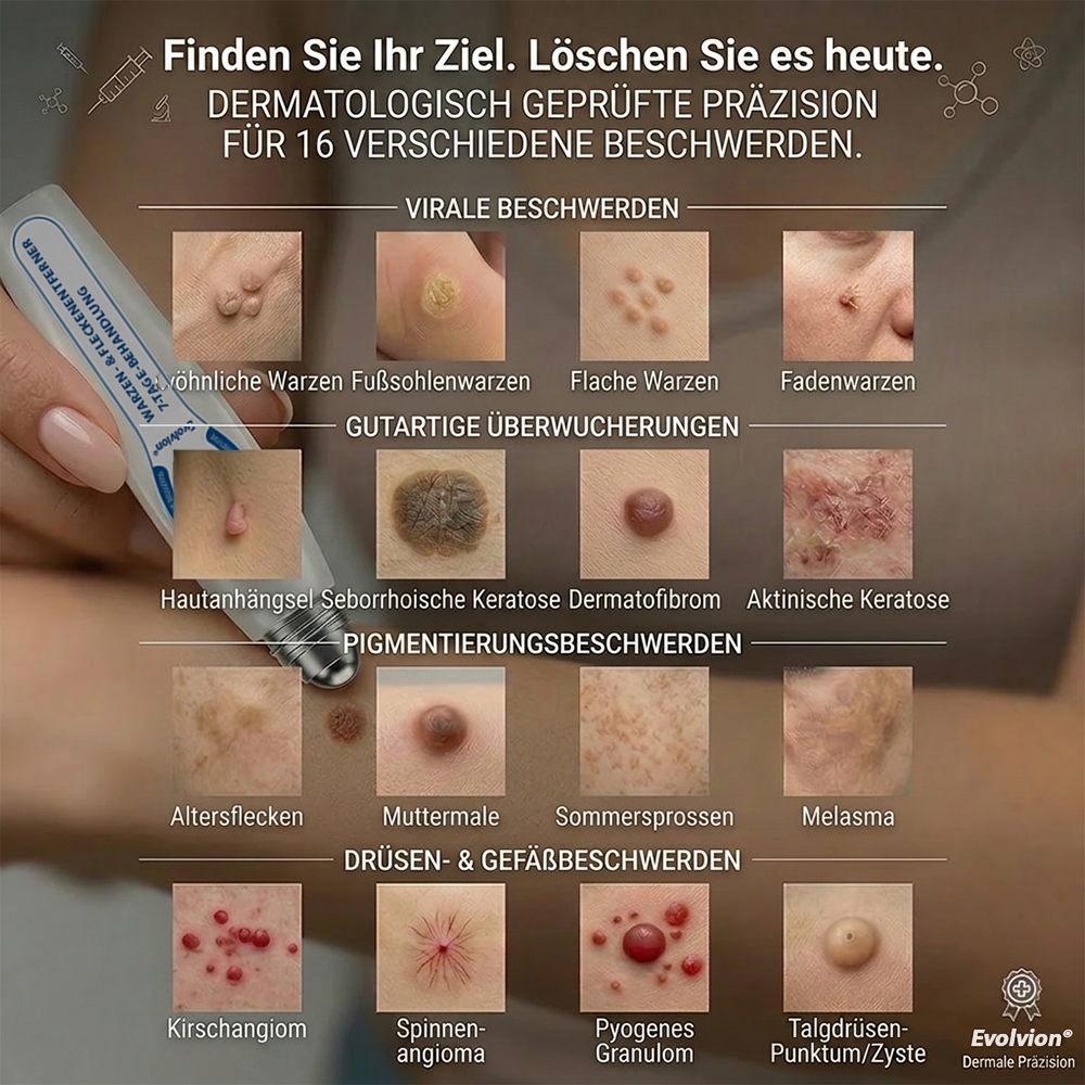 Hergestellt und versandt aus Deutschland ✨Evolvion® 𝟕-𝐓𝐚𝐠𝐞 Hautanhängsel- & Fleckenentferner (𝟕-𝐃𝐚𝐲 𝐒𝐤𝐢𝐧 𝐓𝐚𝐠 & 𝐒𝐩𝐨𝐭 𝐄𝐫𝐚𝐬𝐞𝐫) – Schmerzfreier & narbenfreier fortschrittlicher Roll-on-Stift zur Entfernung von Hautunreinheiten
