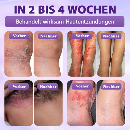 Hergestellt und versandt aus Deutschland ✨❤️Evolvion® Biotin 10-in-1 Hautregenerations-Spray🦅