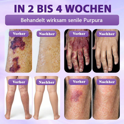 Hergestellt und versandt aus Deutschland ✨❤️Evolvion® Biotin 10-in-1 Hautregenerations-Spray🦅