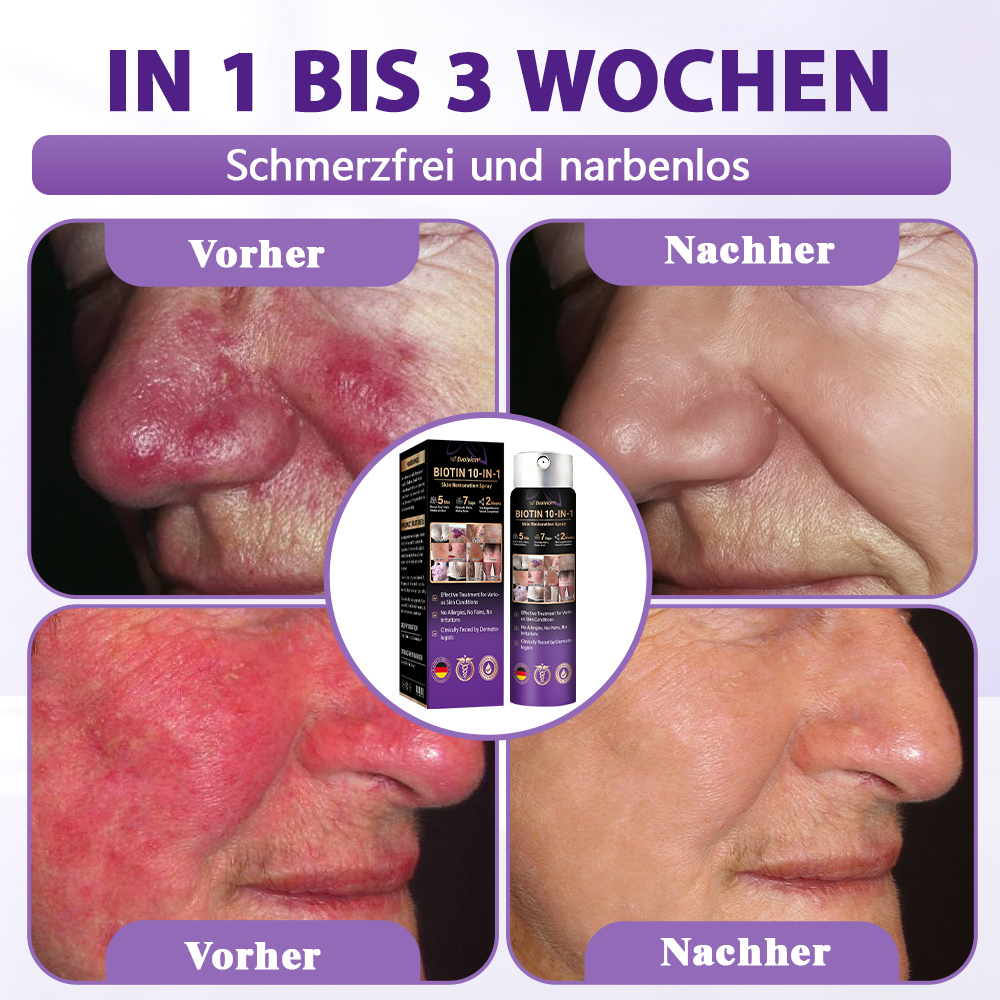 Hergestellt und versandt aus Deutschland ✨❤️Evolvion® Biotin 10-in-1 Hautregenerations-Spray🦅