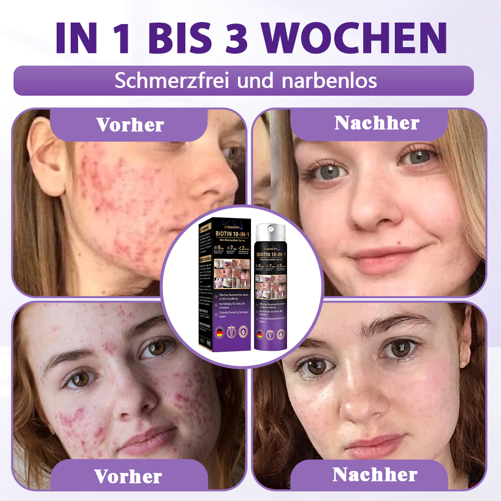 Hergestellt und versandt aus Deutschland ✨❤️Evolvion® Biotin 10-in-1 Hautregenerations-Spray🦅